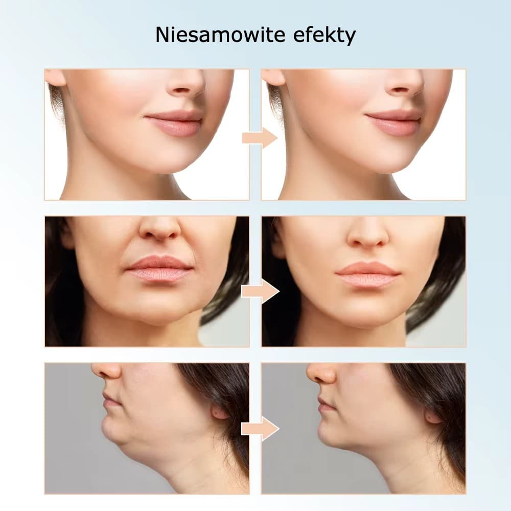 VLift - masażer do twarzy